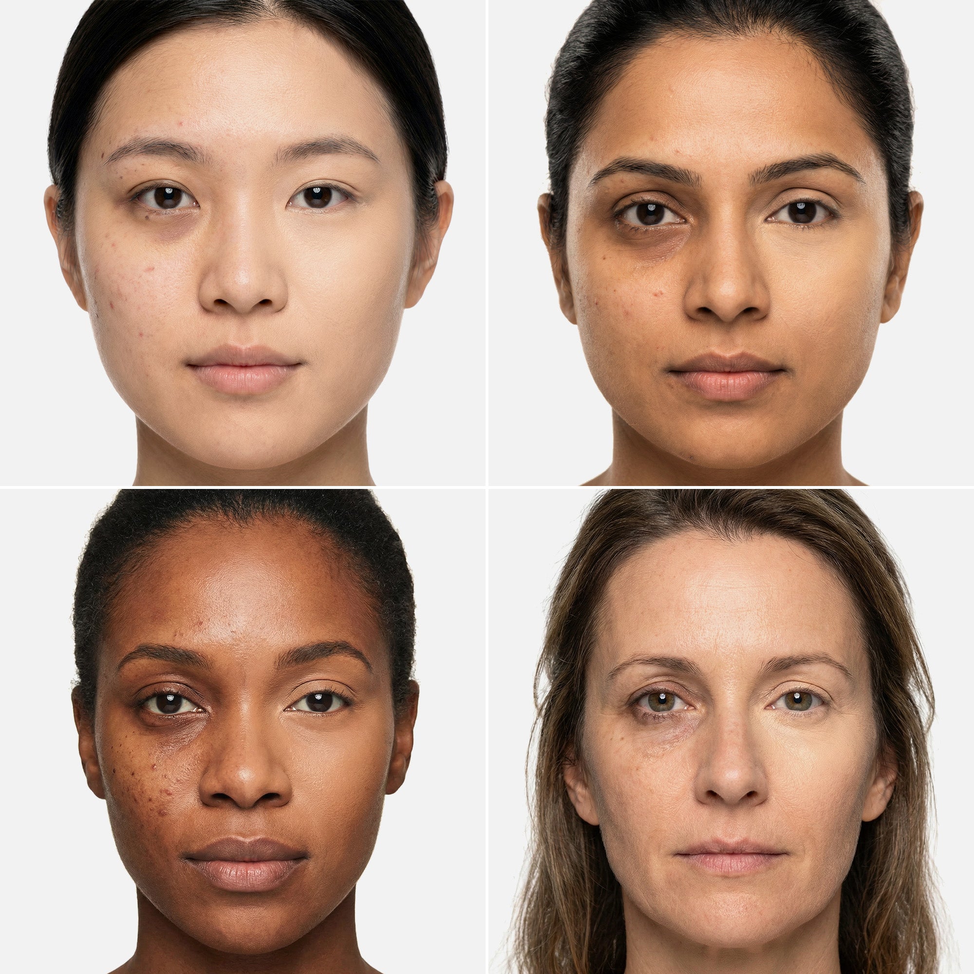 Before-and-after using AMAZINGCONCEALER to conceal dark circles and blemishes, showcasing flawless full-coverage results.