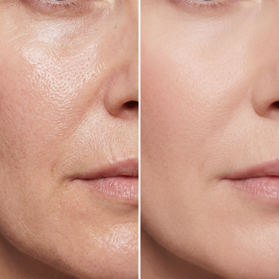Oily Skin & Large Pores? Here’s How to Help Your Makeup