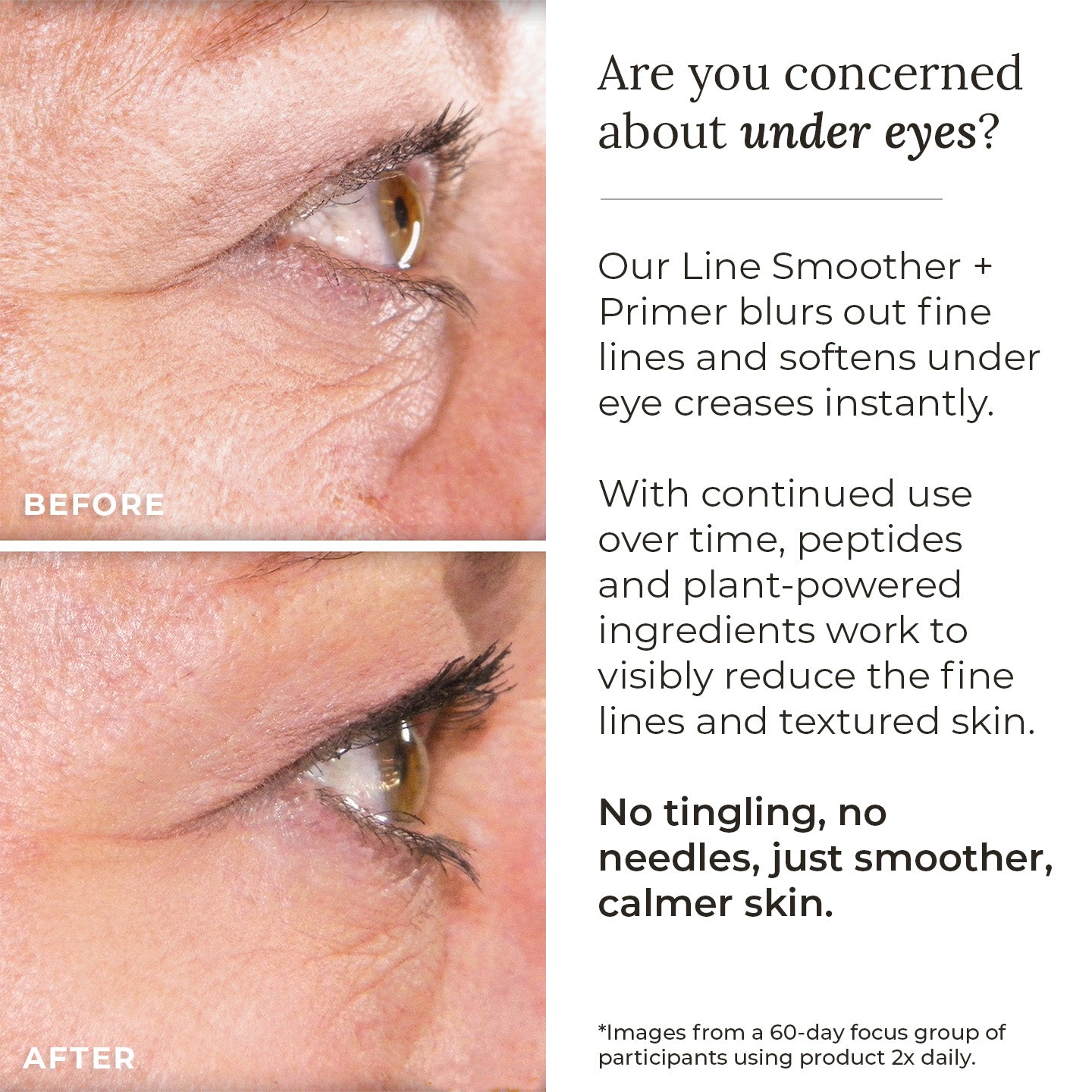 Visibly reduce fine lines and textured skin.