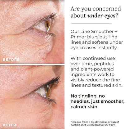 Visibly reduce fine lines and textured skin.
